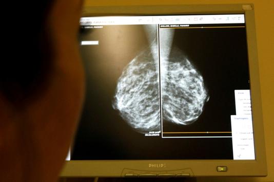 Examen d’une radio après une mammographie, à Nice, en 2008.