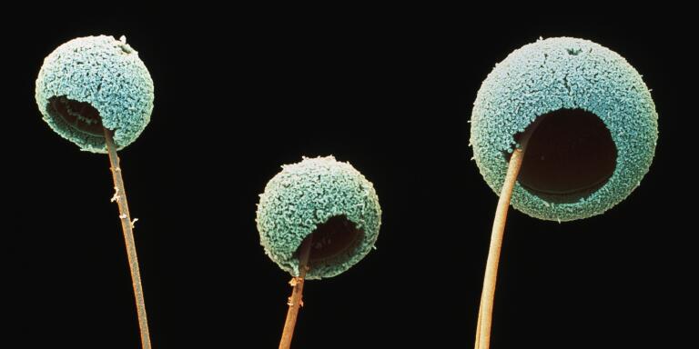 Aspergillus fumigatus fungus. Coloured scanning electron micrograph (SEM) of fruiting bodies of the fungus Aspergillus fumigatus. This fungus causes aspergillosis in humans. The round structures (conidia) are covered in tiny spores, about to be released into the air. A. fumigatus grows in household dust and decaying vegetable matter. Although harmless to healthy people, the fungus can cause complications in people with respiratory complaints or weakened immune systems. Inhalation of the spores may lead to aspergill- osis, infection of the lungs and bronchi, which can be fatal in some cases. Magnification unknown.