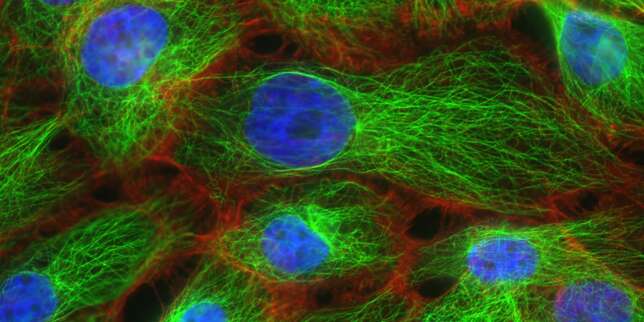 Microscopie à fluorescence de cellules cancéreuses.