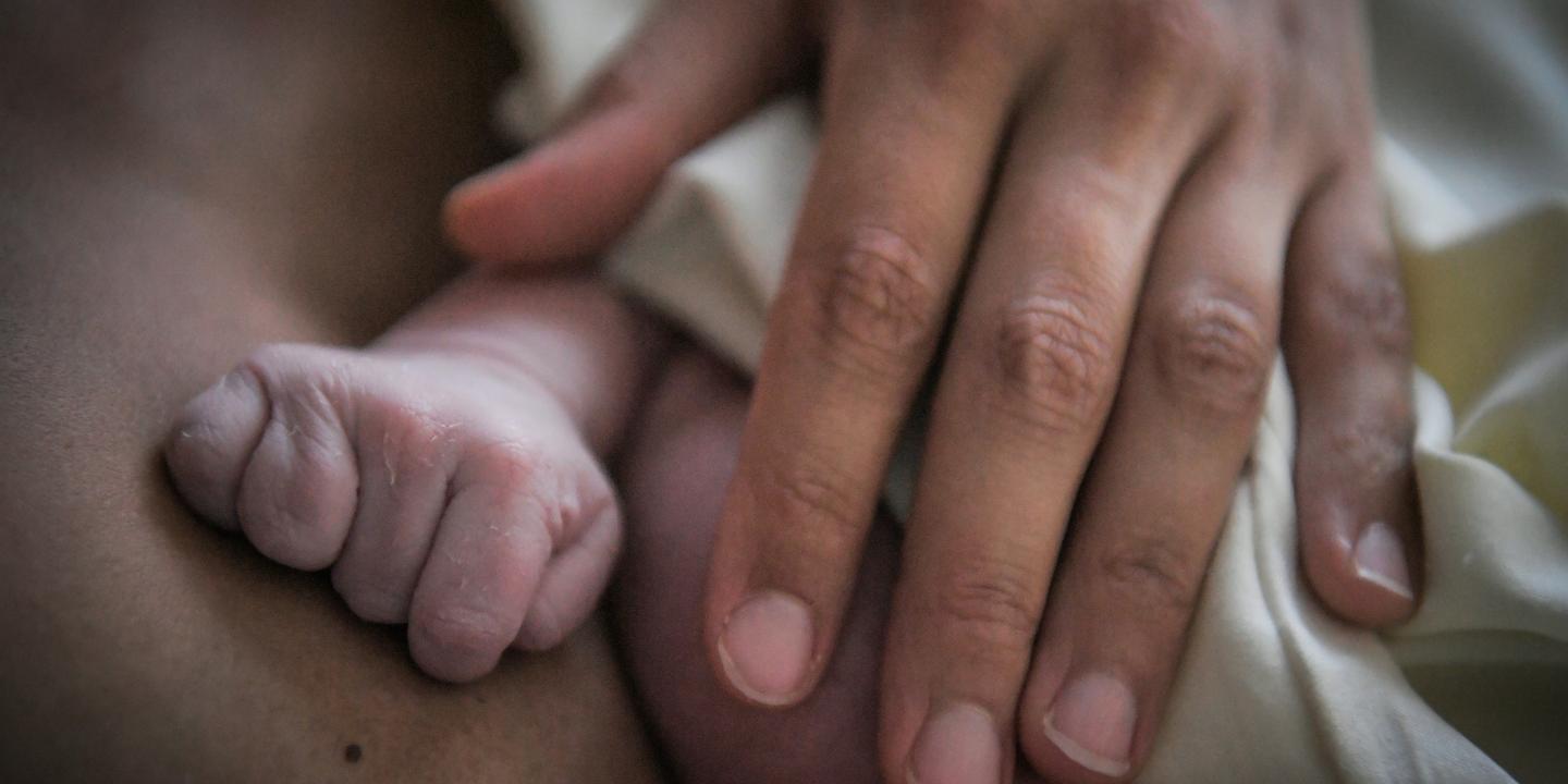 Bebes Sans Bras 18 Cas Recenses Au Total Dans L Ain Bebes Sans Bras 18 Cas Recenses Au Total Dans L Ain