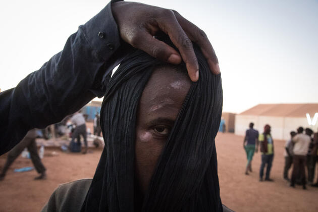 Ce migrant a été frappé au visage lors de son interpellation à Alger. En 2017, 1 871 Ouest-Africains (sans compter les Nigériens) ont été déposés à la frontière. Fin 2018, selon l’OIM, ils étaient six fois plus nombreux. BACHIR POUR LE MONDE