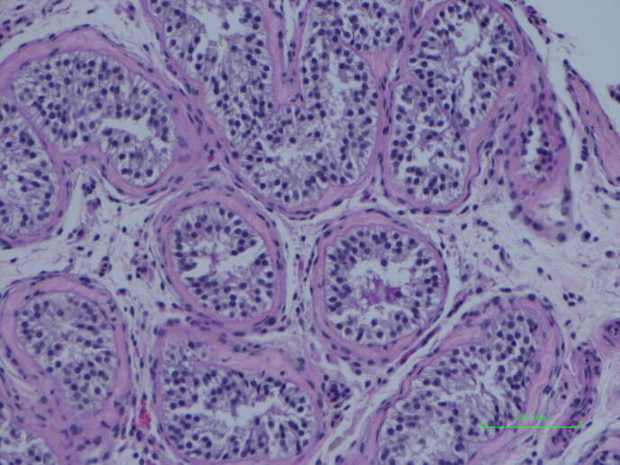 Secciones de testículos que resaltan los túbulos seminíferos (donde tiene lugar la espermatogénesis) rodeados por tejido intersticial (que alberga las células inmunitarias).