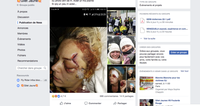 A partir de décembre, les « gilets jaunes » partagent de plus en plus des images de blessés graves. Souvent chocs, elles suscitent indignation, émoi et solidarité.