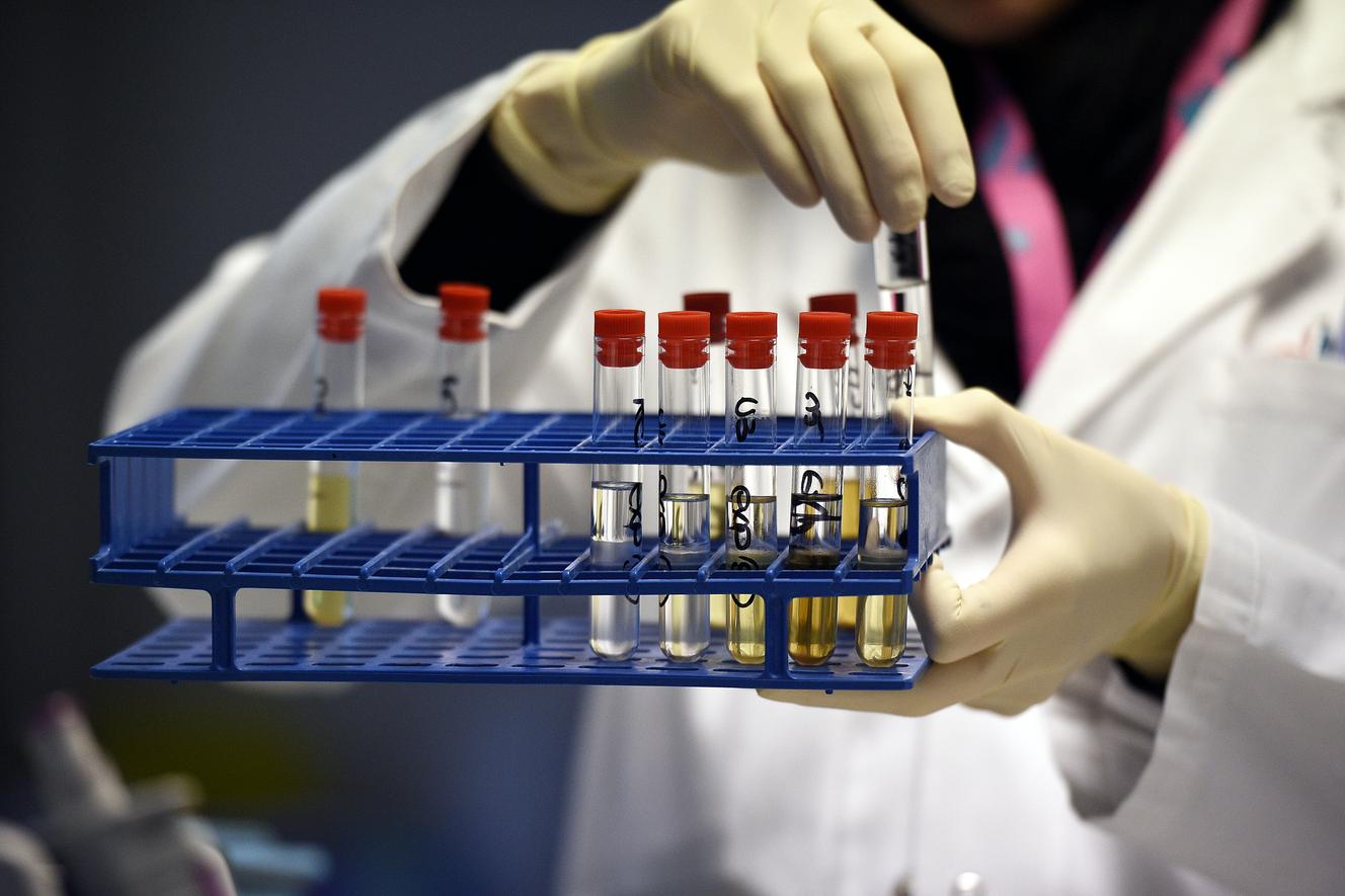 Des difficultés dans l’organisation des contrôles antidopage en France