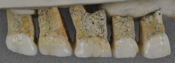Dents supérieurs droites de l’individu CCH6 découvert au Philippines, qui a servi à définir une nouvelle espèce d’hominine, « Homo luzonensis ». De gauche à droite, deux prémolaires et trois molaires en vue linguale.