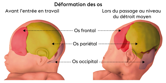 Comment Le Crane D Un Bebe Se Deforme A L Accouchement Comment Le Crane D Un Bebe Se Deforme A L Accouchement