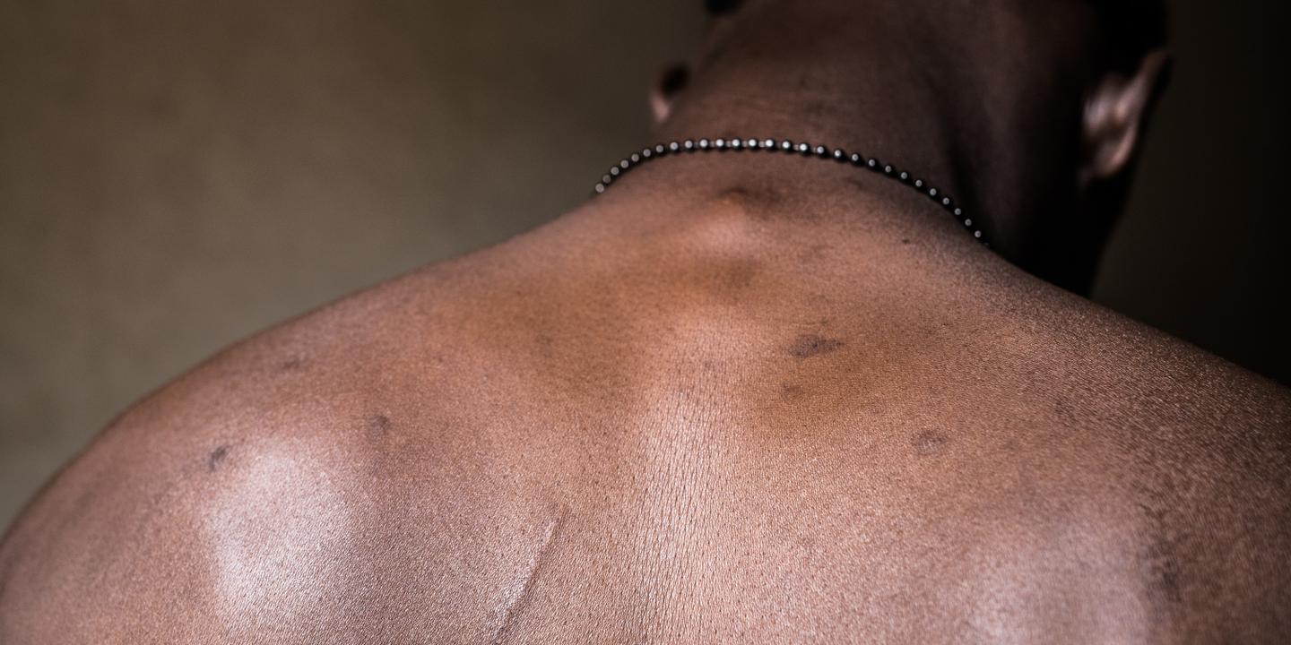 CESAR DEZFULI POUR Portrait anonyme d'un des migrants qu'avait rencontré le photographe Cesar Dezfuli le 1er août 2016, et qu'il a ensuite retrouvé, sur le continent européen, en 2018. Plusieurs d'entre eux ont été enlevé et torturé en Libye. Séquestré, il ont subi des coups et des brûlures, et ont parfois été réduits au travail forcé, avant de parvenir à s'évader.