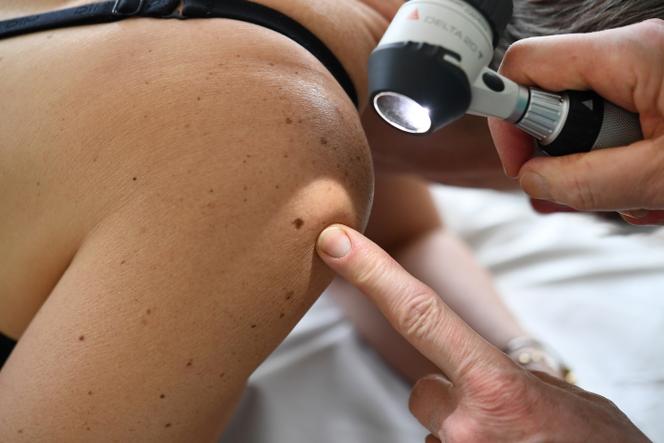 Un dermatologue examine les grains de beauté d’un patient à Quimper, dans l’ouest de la France, le 22 mai 2019.