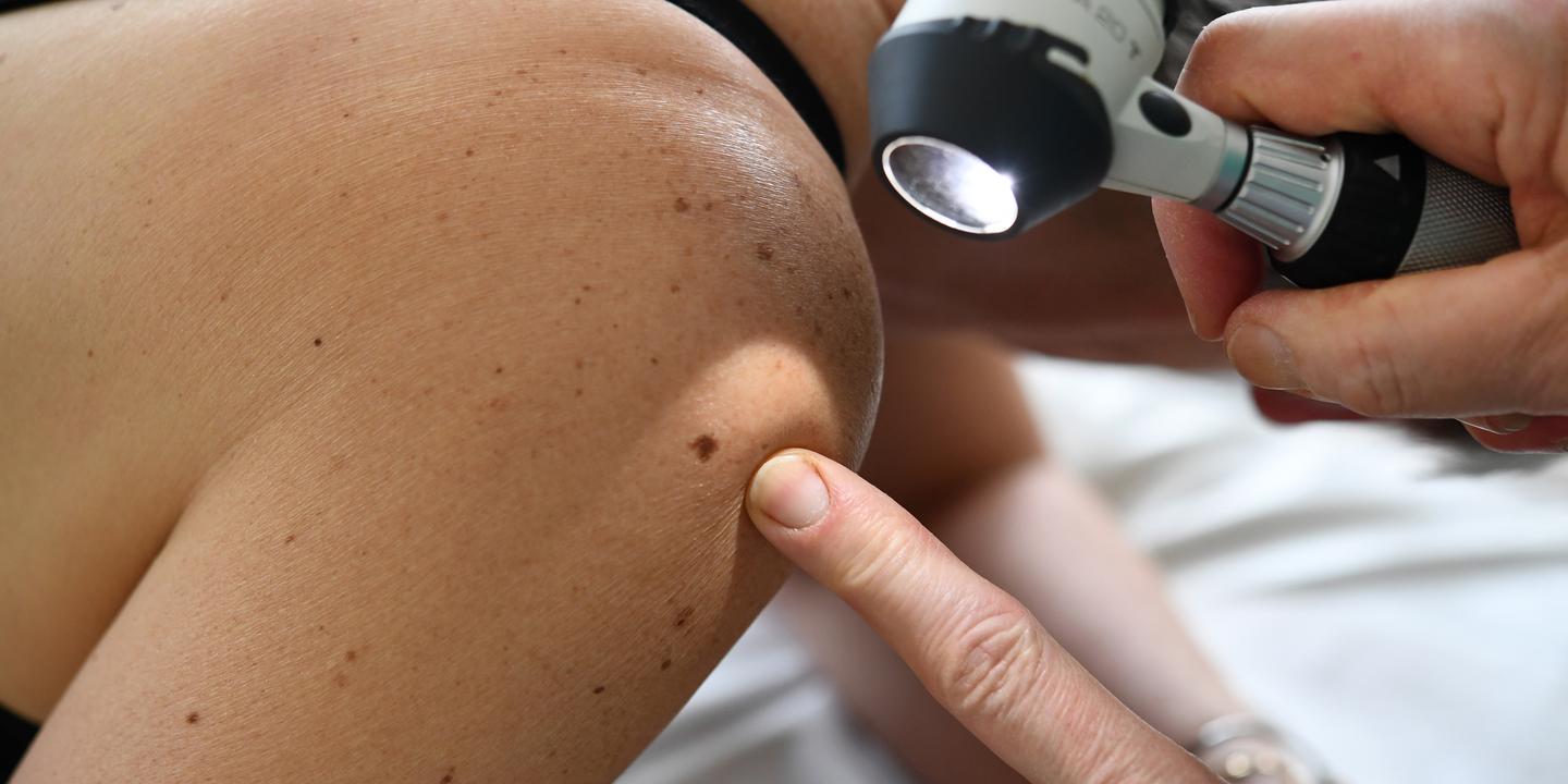 Cancer: France must know why it has higher exposure rates