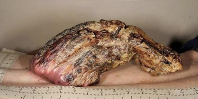 Une « corne de dragon » lui pousse dans le dos