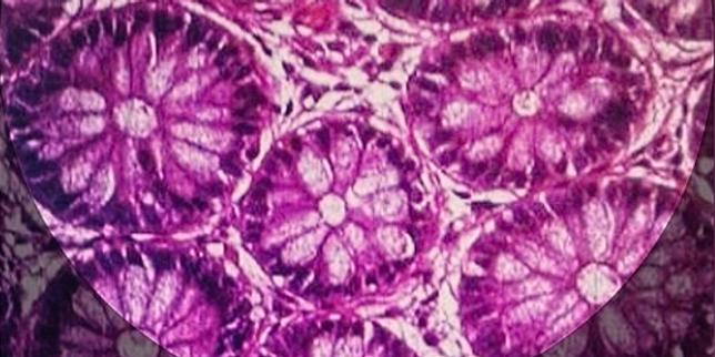 Contrer l'agresseur intestinal sans nuire au simple passant