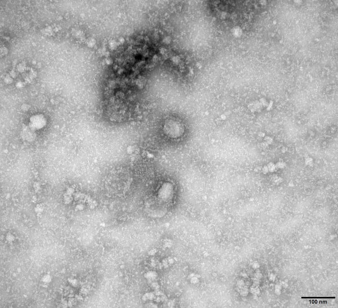 Une photographie du 2019-nCov prise par microscope électronique transmise par les autorités chinoises. Deux des exemplaires du virus sont visibles au centre, sous la tache sombre.