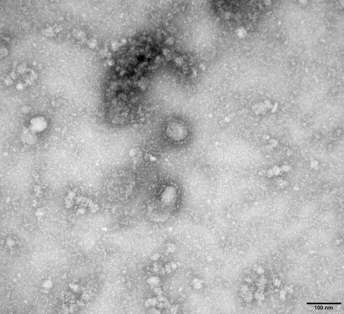 Une photographie du 2019-nCov prise par microscope électronique transmise par les autorités chinoises. Deux des exemplaires du virus sont visibles au centre, sous la tache sombre.