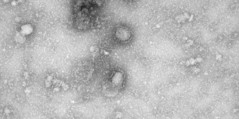 Une photographie du 2019-nCov prise par microscope électronique transmise par les autorités chinoises. Deux des exemplaires du virus sont visibles au centre, sous la tache sombre. IVDC, CHINA CDC VIA GISAID / via REUTERS