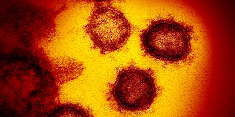 FILE - This undated electron microscope image made available by the U.S. National Institutes of Health in February 2020 shows the Novel Coronavirus SARS-CoV-2. Also known as 2019-nCoV, the virus causes COVID-19. The sample was isolated from a patient in the U.S. On Friday, Feb. 21, 2020, The Associated Press reported on a video circulating online incorrectly asserting that man in Wuhan, China, was sanitizing his apartment with alcohol when the air conditioner came on and caused an explosion and fire. The fire captured on video was the result of a cigarette that was improperly put out on a comforter. The comforter then ignited and was placed on a balcony where nearby debris caught fire in Chongqing, China, a city hundreds of miles away from Wuhan. (NIAID-RML via AP)
