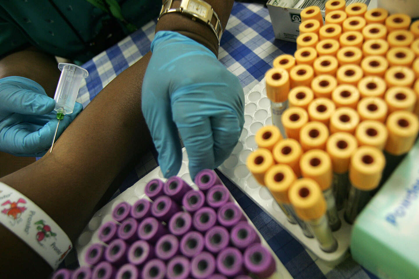 Des Sud-Africaines porteuses du VIH stérilisées de force dans des hôpitaux du pays
