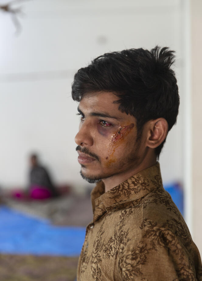 Un blessé à l’hopital Al Hind, dans le nord de New Delhi, le 26 février.