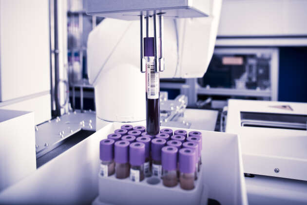 Echantillons de sang en cours de traitement pour stockage à la UK Biobank. Tous les échantillons sont codés de manière anonyme et le robot dans le congélateur peut les sélectionner en fonction de leur identifiant anonyme.