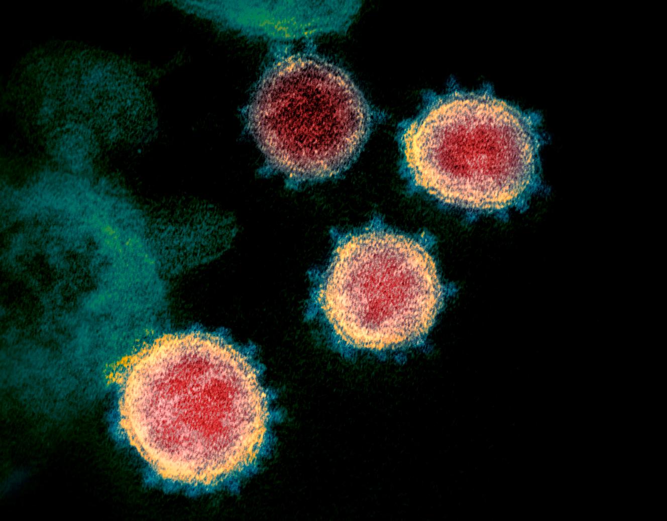 L’étrange obsession d’un quart des Français pour la thèse du virus créé