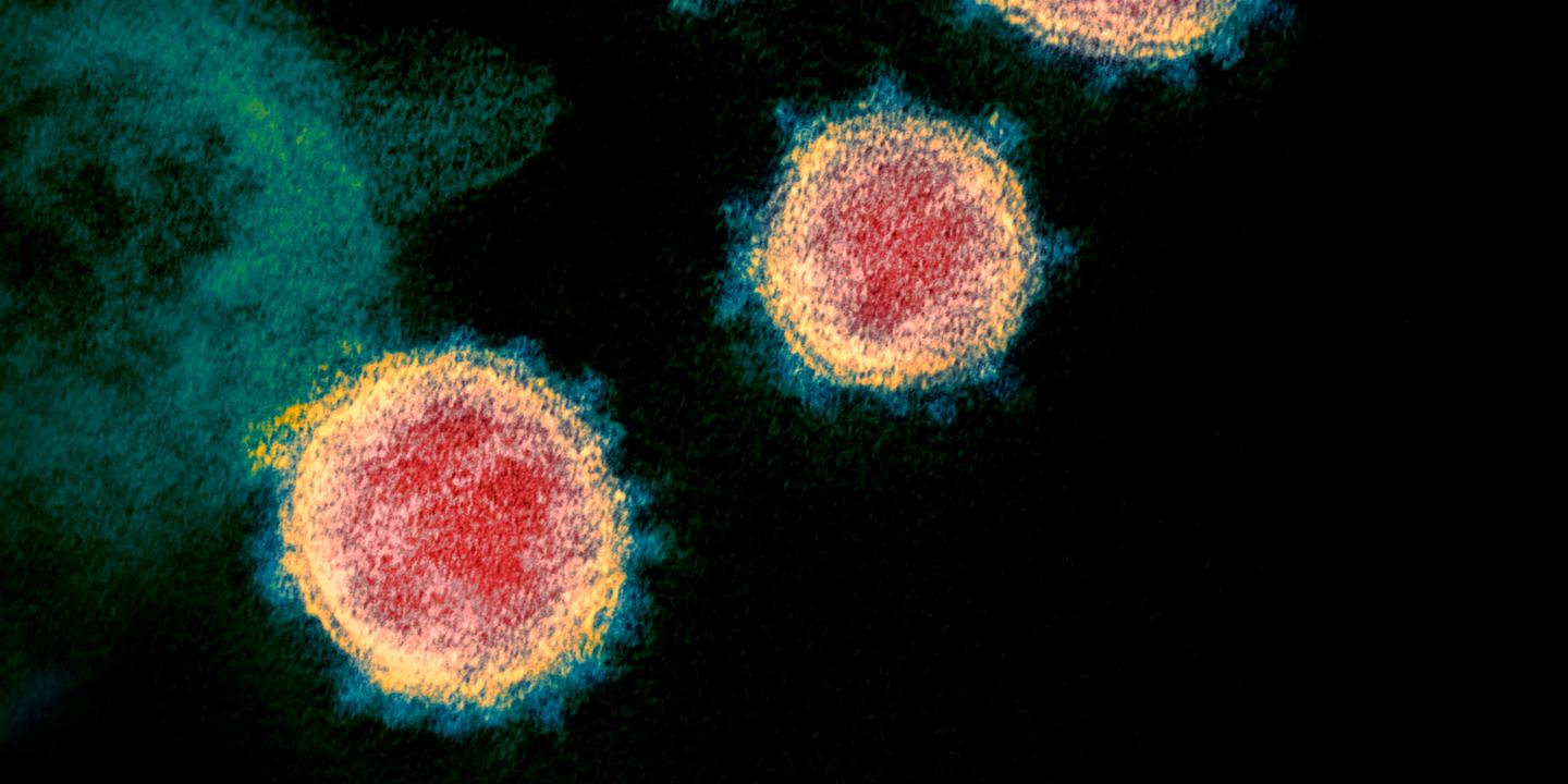 quelles differences y a t il entre le coronavirus et la grippe