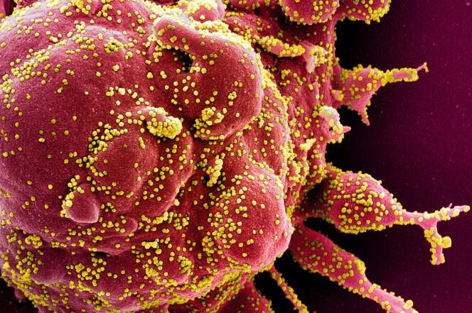 Image en fausses couleurs obtenue par microscope électronique à balayage d’une cellule (rouge) infectée par le SARS-CoV-2 (jaune).
