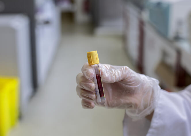 Un tube de prélèvement pour effectuer un test sérologique, dans un laboratoire d'analyse à Villeneuve-la-Garenne (Hauts-de-Seine), le 22 mai.