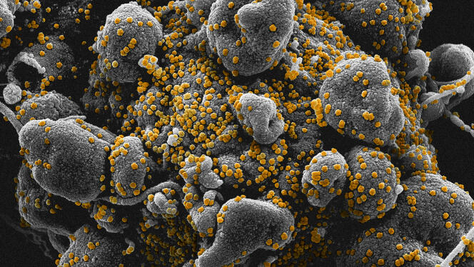 Image colorisée obtenue au microscope électronique montrant le SARS-CoV-2 (jaune) émergeant à la surface de cellules cultivées en laboratoire (gris).