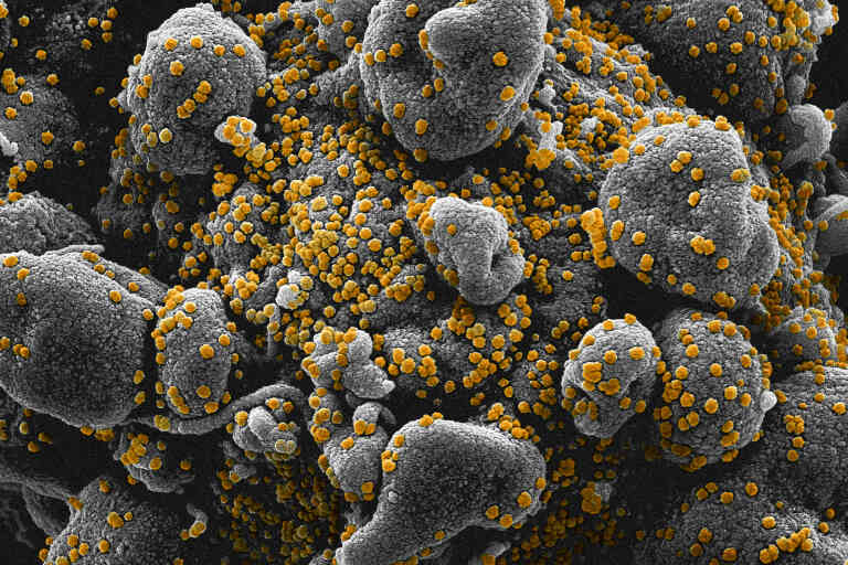 Image colorisée au microscope électronique à transmission montrant le SARS-CoV-2, également connu sous le nom de 2019-nCoV, le coronavirus qui cause le COVID-19. Cet échantillon a été isolé d'un patient aux États-Unis. Des particules du virus (jaune) émergent à la surface des cellules cultivées en laboratoire (bleu / rose)