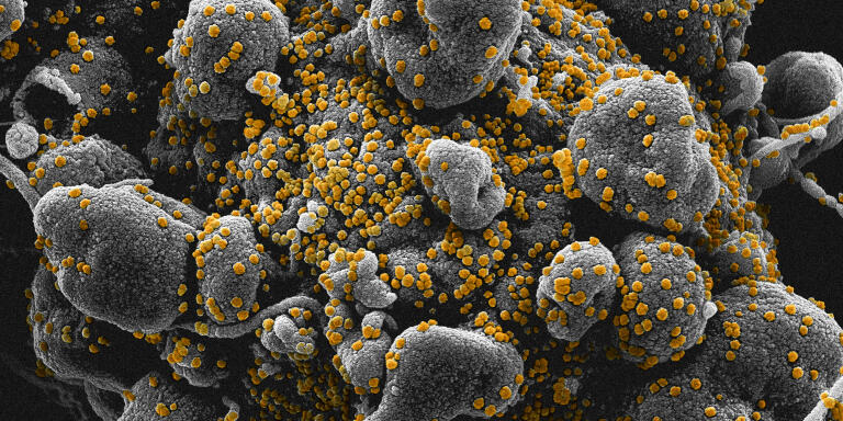 Image colorisée au microscope électronique à transmission montrant le SARS-CoV-2, également connu sous le nom de 2019-nCoV, le coronavirus qui cause le COVID-19. Cet échantillon a été isolé d'un patient aux États-Unis. Des particules du virus (jaune) émergent à la surface des cellules cultivées en laboratoire (bleu / rose)