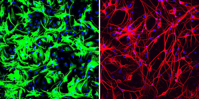 Des atrocytes (en vert) sont transformées en neurones (en rouge).