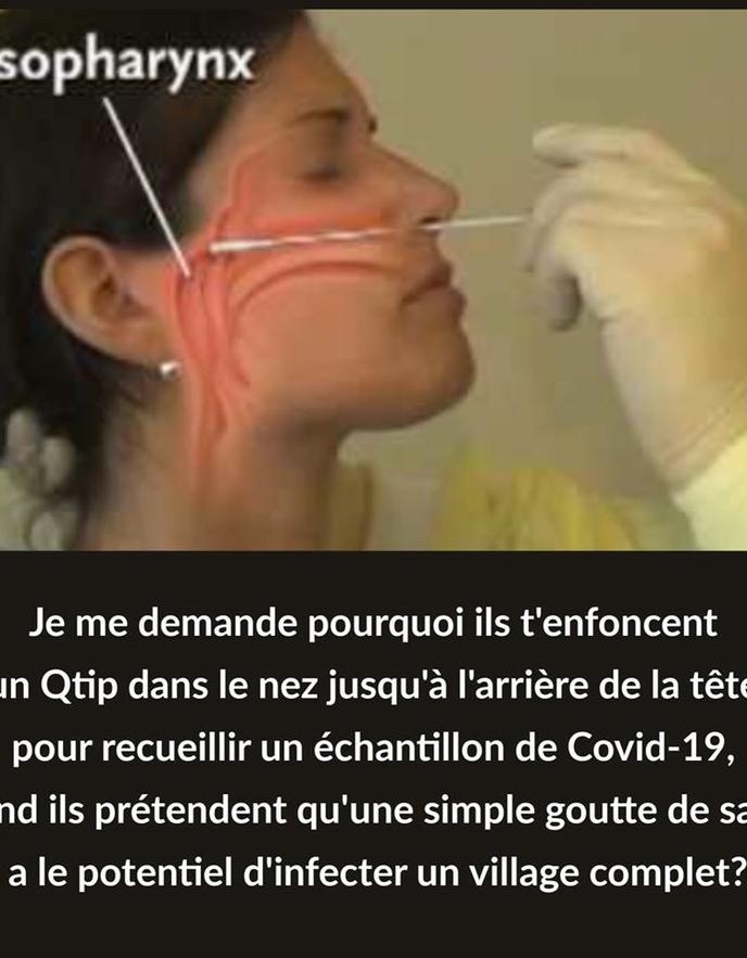 Coronavirus Pourquoi Les Tests Pcr Necessitent D Aller Au Fond Du Nez