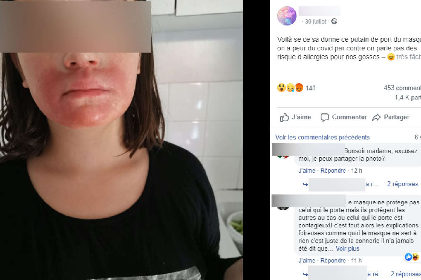 Femme Avec Des Allergies De Combat De Ressort De Masque De