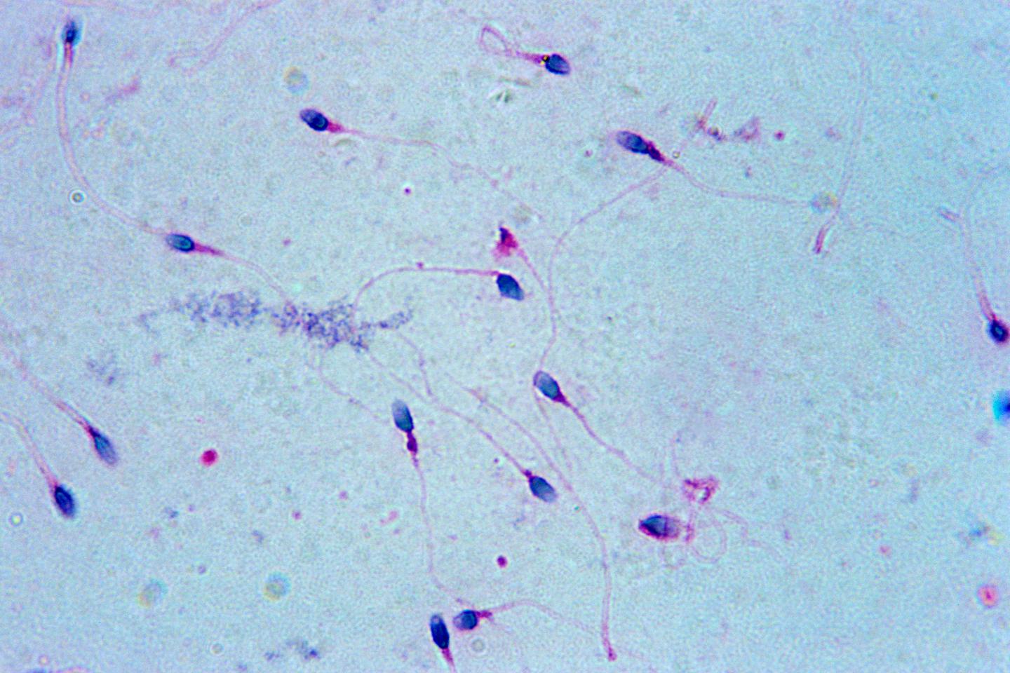 Les Spermatozo des Nagent Comme Des Loutres Et Non Comme Des Anguilles les-spermatozo-des-nagent-comme-des-loutres-et-non-comme-des-anguilles