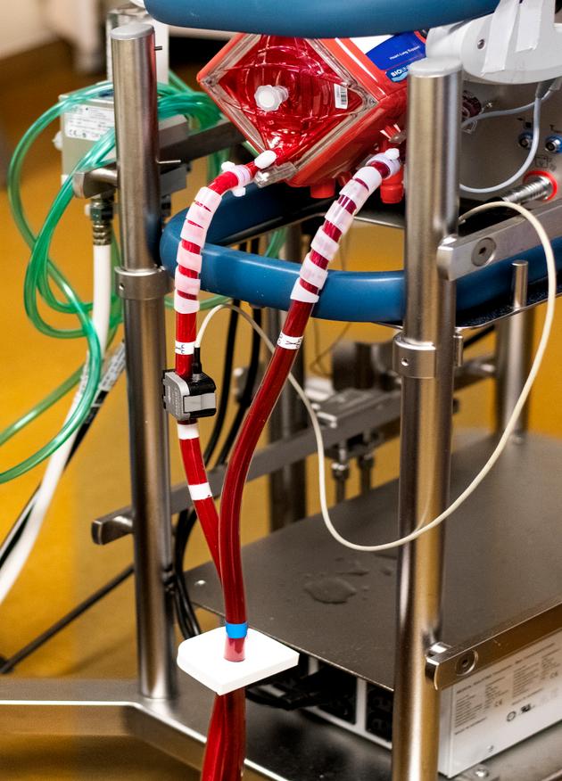 A l’hôpital de la Pitié-Salpêtrière, le 17 septembre, à Paris.La machine ECMO retient le dioxyde de carbone présent dans le sang avant de l'oxygéner. Le sang oxygéné est ensuite remis en circulation dans le corps du patient.