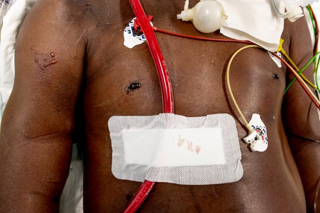 Dans le service de réanimation de l’hôpital de la Pitié-Salpêtrière, à Paris, le 17 septembre.