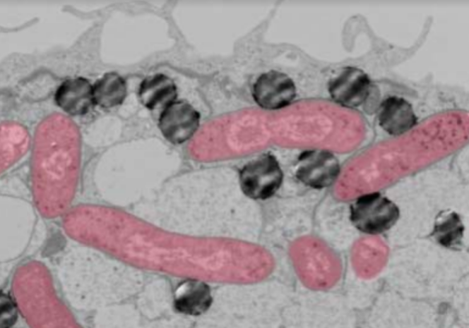 Des gouttelettes lipidiques (gris sombre) à l’assaut de bactéries E. coli (en rose) dans une cellule macrophage humaine.