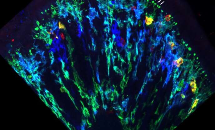 Coupe de côlon dans laquelle on observe les macrophages subépithéliaux et leursprotubérances en forme de ballon en vert.