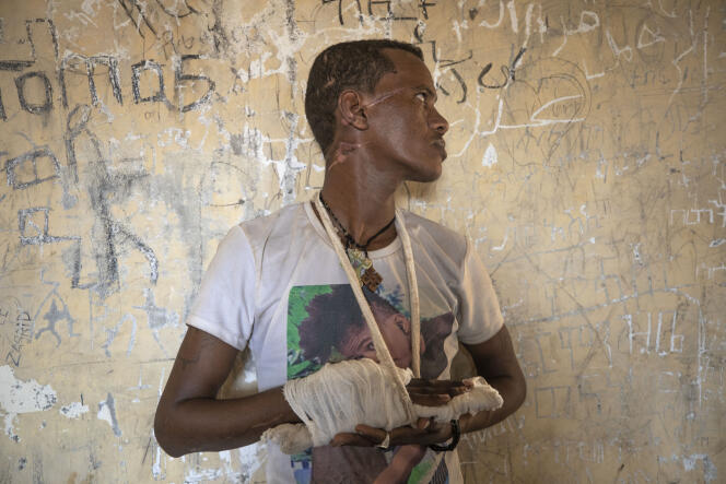 Abrahaley Minasbo, un survivant du conflit au Tigré. Il montre ses cicatrices à Hamdeyat (Ethiopie), le 15 décembre 2020.