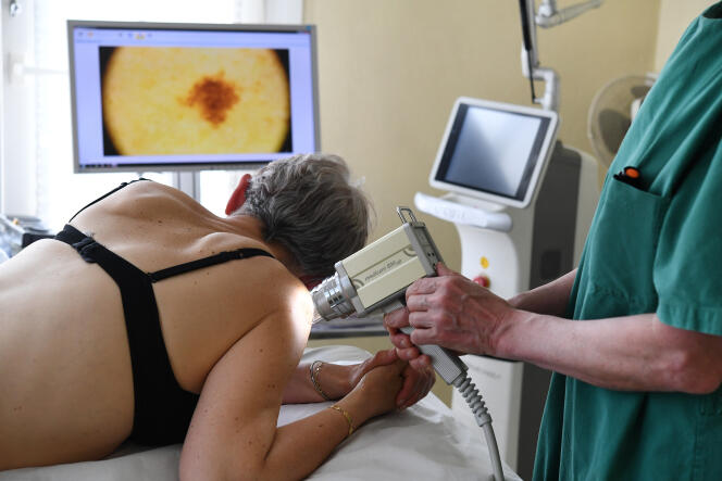 Dépistage du cancer de la peau, à Quimper (Finistère), en mai 2019.