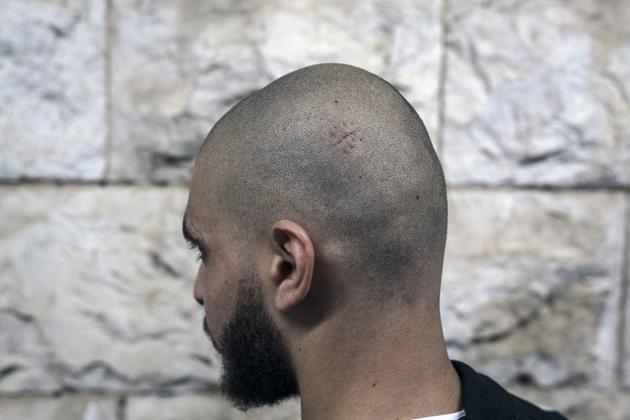 21-letni Omar jest palestyńskim obywatelem Izraela.  Mówi, że 12 maja został tak ciężko pobity przez policję, że zabrano go do szpitala ze zszytą żabą i nadal ma zawroty głowy.  2 czerwca 2021 w Nazarecie.