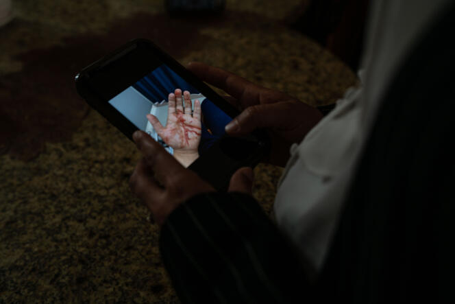 Shatha Hammad montre sur son téléphone une photo de la blessure dont elle a été victime lors d’une manifestation quelques jours plus tôt. A Silwad (Palestine), le 30 juin 2021.