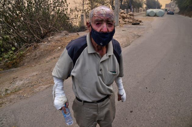 Cerca de Tizi-Ouzou, un hombre herido, envuelto en vendas, camina por la calle con el cráneo cubierto de ceniza, otros son transportados en camillas, señaló un fotógrafo de la Agence France-Presse (AFP).