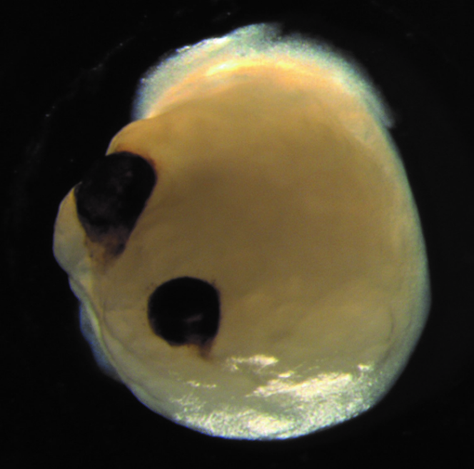 Un cérébroïde doté d’embryons d’yeux.