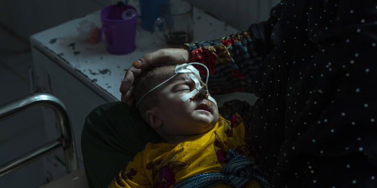 Une employée de MSF tient dans les mains un enfant souffrant de grande malnutrition dans l’unité de nutrition thérapeutique de l’hôpital MSF de Lashkar Gah, ou chaque lit est occupé par deux enfants. Le 7 novembre.