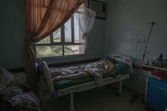 A man receives treatment at a hospital in Marib, Yemen on June 21, 2021. He was seriously injured when a ballistic missile and an explosive-laden drone fired by Houthi rebels in Yemen hit a gas station in the district of Rawdha.