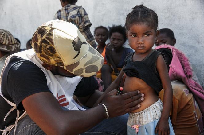 Depuis mars 2021, Médecins sans frontières a mis en place une présence permanente dans le Sud de Madagascar afin de venir en aide aux populations en urgence. Ici, à Befeno, en septembre 2021.