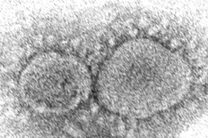 Esta imagen microscópica, publicada por los Centros para el Control y la Prevención de Enfermedades de EE. UU., Muestra partículas del virus SARS-CoV-2 que causan Covid-19.