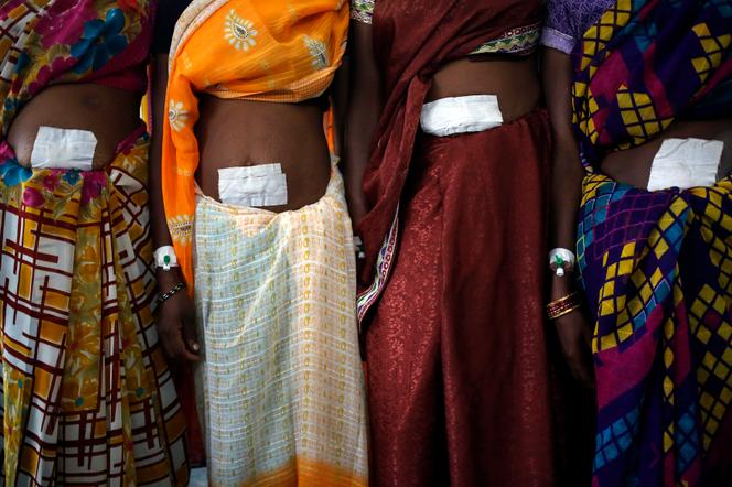 Women undergoing sterilization surgery at a government mass sterilization camp at a hospital in Bilaspur district, Chhattisgarh state, India on Nov. 14, 2014.