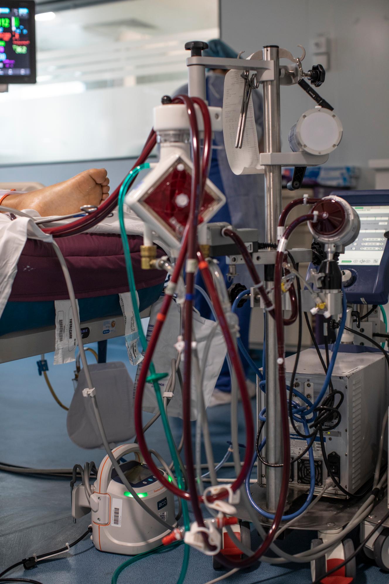 Ecmo (machine d’oxygénation du sang extracorporelle) sur un patient Covid-19 non-vacciné, le 31 décembre 2021.