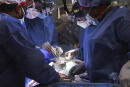 In this photo provided by the University of Maryland School of Medicine, members of the surgical team perform the transplant of a pig heart into patient David Bennett in Baltimore on Friday, Jan. 7, 2022. On Monday, Jan. 10, 2022 the hospital said that he's doing well three days after the highly experimental surgery. (Mark Teske/University of Maryland School of Medicine via AP)